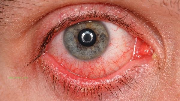 What foods are good for the eyes to eat