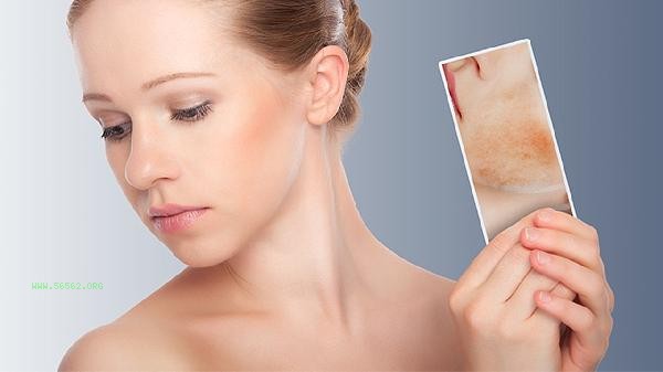 How to get rid of dry skin in autumn