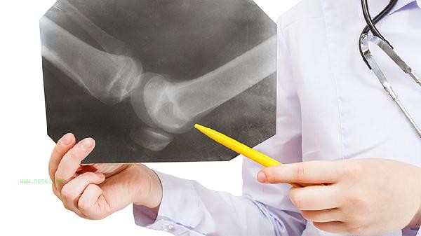 Will bones become heavier in middle age