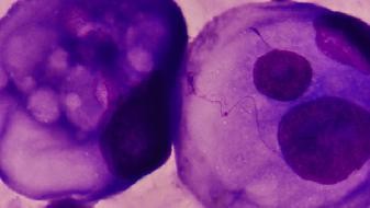 When did the COVID-19 Omicron virus appear? Is the Omicron virus stronger than Deltavirus
