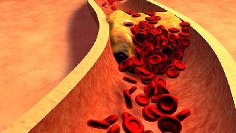10 personal suggestions for preventing COVID-19