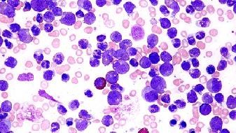 Can novel coronavirus survive in the air? How long can novel coronavirus survive
