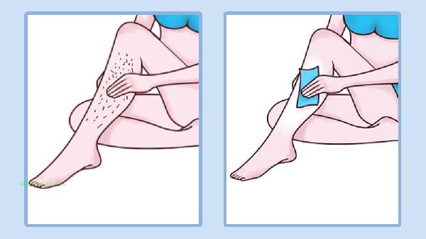 How much does the 808 hair removal device cost per unit