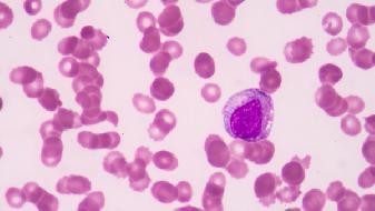 When did the COVID-19 epidemic begin? It was found earlier in many countries around the world