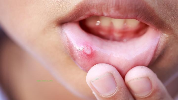 What should I do if I regret my ultrasonic teeth cleaning