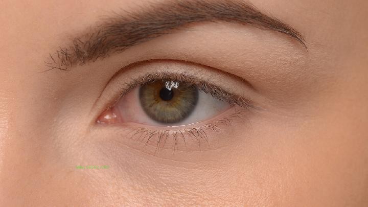 What happened to the small lump at the end of the eye line after one month of buried double eyelid surgery?