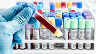 Can COVID-19 Intensive Acupuncture Be Used for Hypertension Patients? What Should Be Paid Attention to when COVID-19 Vaccine is Used for Hypertension Patients