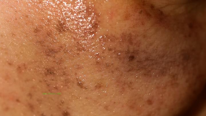 What is the typical price for speckles
