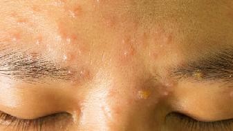 What are the benefits and drawbacks of eyebrow tattooing?
