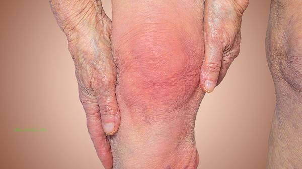 How to treat gout in elderly people with traditional Chinese medicine