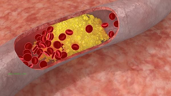 What are the health hazards of high red blood cell count