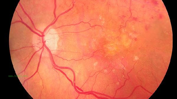 What is the normal range of vascular resistance index