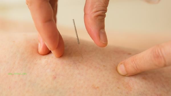 Treatment of spinal cord injury with acupuncture and moxibustion and moxibustion