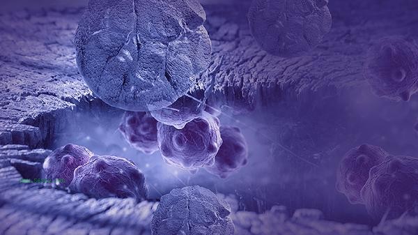 What is the reason for high eosinophil count