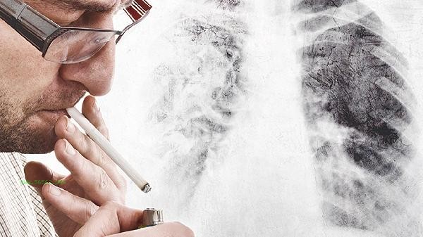 Can smoking cause hair loss