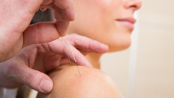 Is acupuncture and moxibustion Therapy Effective for Prolapse of Intervertebral Disc