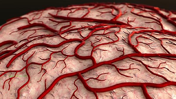 What can happen with neuromuscular syndrome