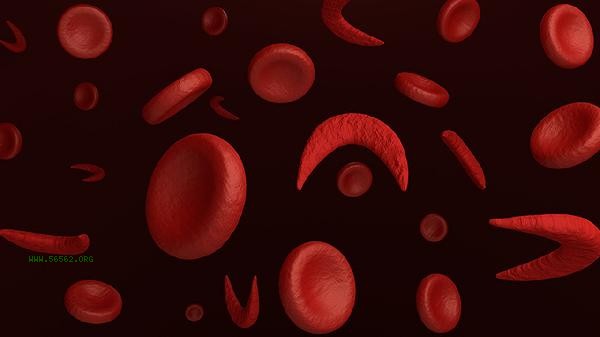 What is the reason for high average volume of red blood cells