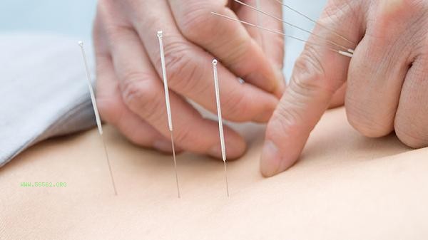 Can buried thread weight loss reduce local weight loss