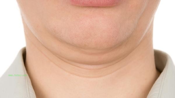 How much does it cost to have a chin liposuction