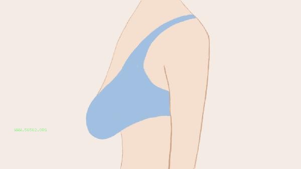 What should I do if I have a hard lump after a year of autologous fat breast augmentation