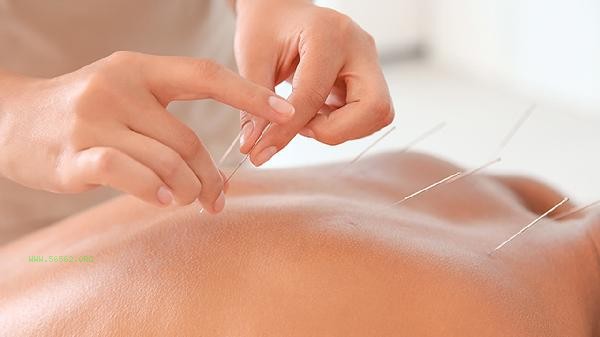 How much does acupuncture and moxibustion catgut embedding cost to lose weight