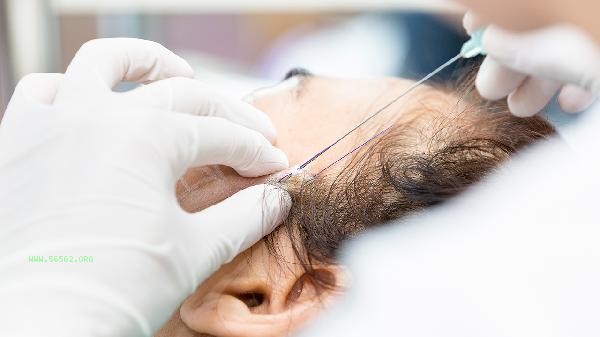 Does the pre examination of thread embedding for weight loss have an impact