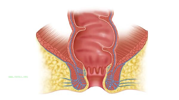 Can I only sleep on my stomach after liposuction to fill my buttocks