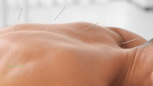 Is buried thread weight loss where to bury and where to lose weight