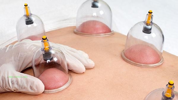 What should I do if I don't lose weight after seven days of cupping