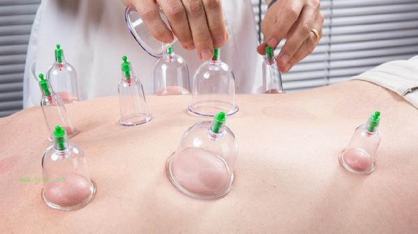 Why does cupping lose weight quickly