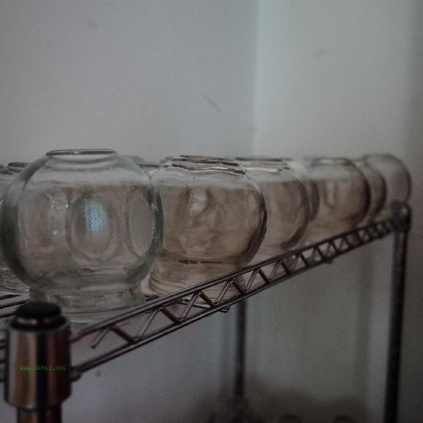 When is the best time for cupping weight loss