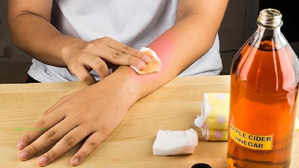How long does it take for arm liposuction to recover