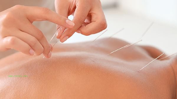 What does acupuncture and moxibustion catgut embedding mean