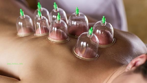 Can cupping on the stomach be done every day for weight loss