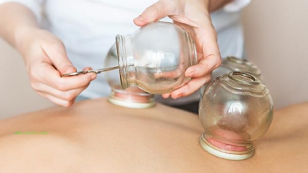 What are the acupoints for cupping and weight loss
