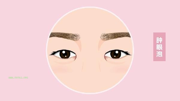 Price of liposuction for swollen eye blisters