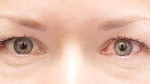 How much does eye liposuction cost
