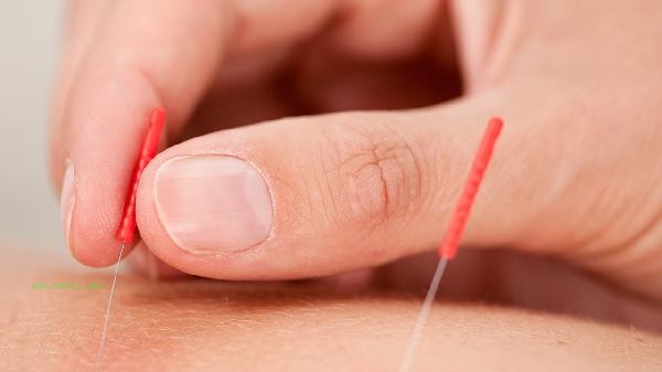 What are the hazards of thread embedding for weight loss