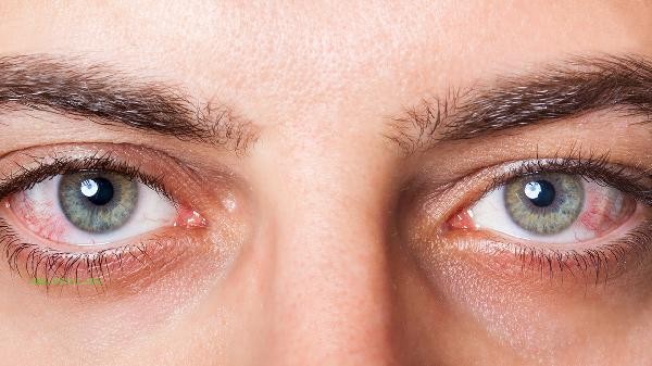 How much does it cost to remove fat from swollen eye blisters