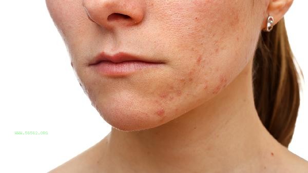 How to reduce the flesh and bones from chin to neck