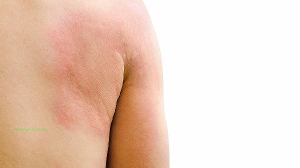 What causes thick upper arms and how can they be reduced