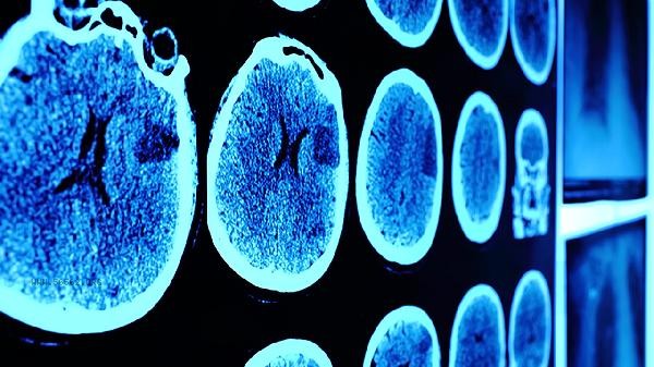 Brain Memory Training Course