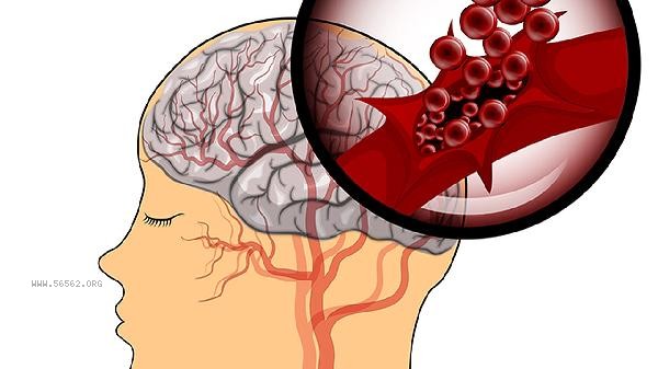 What medicine is good for brain memory loss