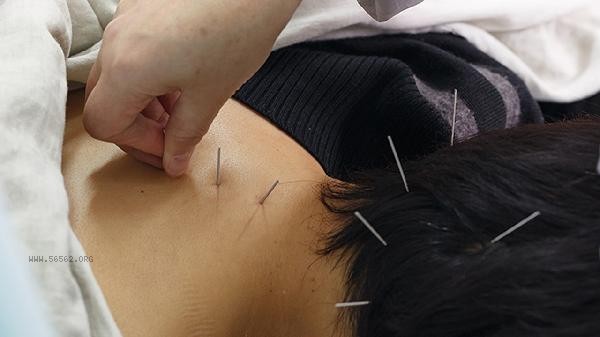 Can I sleep together after acupuncture and moxibustion