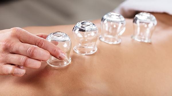 Can we have sexual intercourse after cupping
