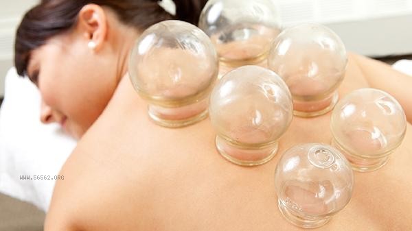Can I sleep naked after cupping