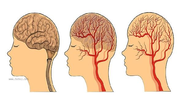 The brain always can't control its wild thoughts