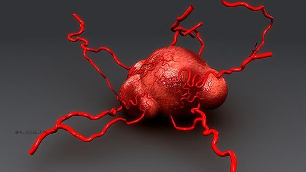 What diseases can women with high lymphocyte count get