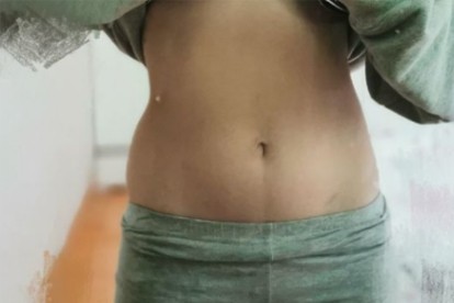 A simple method to reduce belly fat